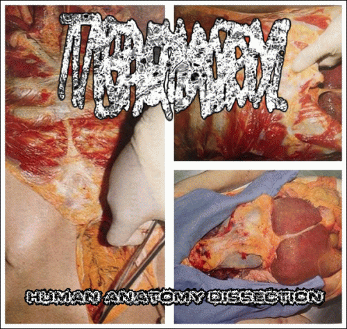 Traumatic Brain Injury : Human Anatomy Dissection